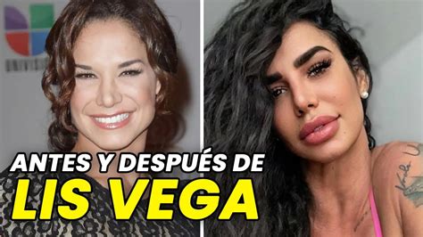 lis vega antes y después|ANTES Y DESPUÉS DE LIS VEGA. Así es como ha cambiado la。